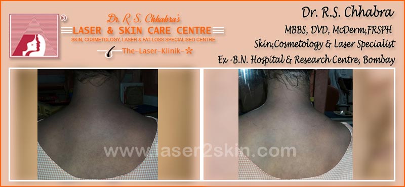 Oxy Derma Therapy by Dr R.S. Chhbara